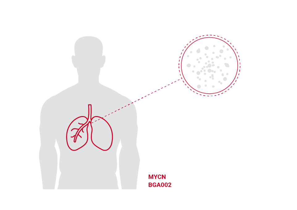 Adult tumors